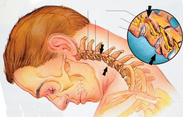 La struttura delle vertebre cervicali